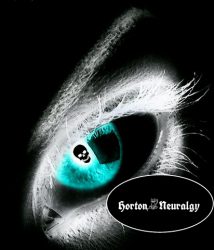 Horton neuralgia – Cluster headache – Itsemurhapäänsärky